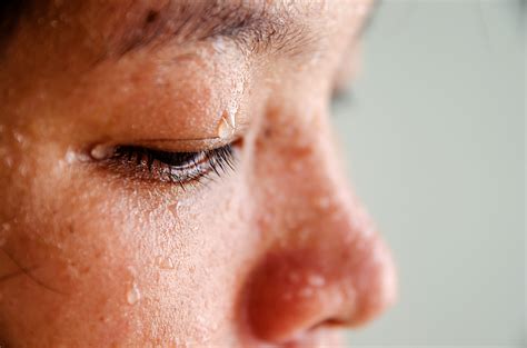 can sweating sickness disappear.